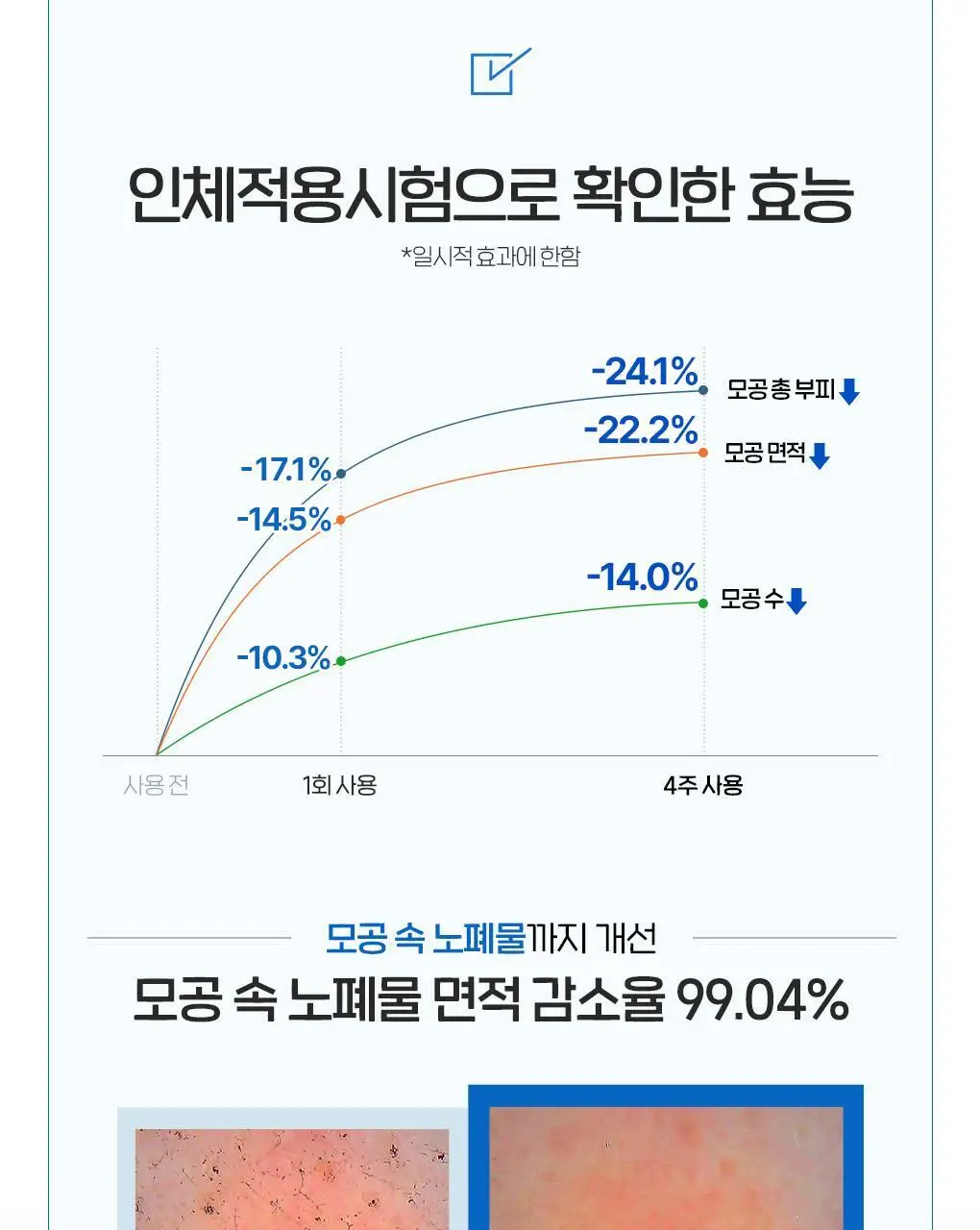 [이나연 PICK] 폰즈 모공 타이트닝 매듭 팩클렌저 150ml 더블기획 (+15ml 증정) 상세페이지 18